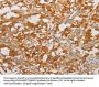 Rabbit anti-human BNIP3 polyclonal antibody