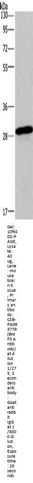 Rabbit anti-human BNIP3 polyclonal antibody