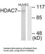HDAC7 Antibody