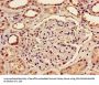 BMP2 Antibody