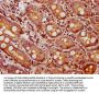 BMP2 Antibody