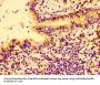 CTGF Antibody