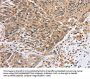 PTPN4 Antibody