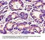 TUBA4A Antibody