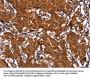 HCAR2 Antibody