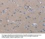 PDE4D Antibody