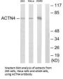 ACTN1/ACTN2/ACTN3/ACTN4 Antibody