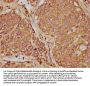 OSM Antibody