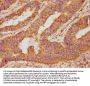 OSM Antibody
