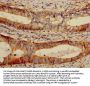 LGALS7 Antibody