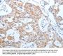 CEACAM5 Antibody