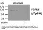 Phospho-FGFR1 (Tyr654) Antibody