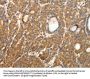 SYT11 Antibody