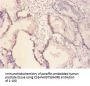ERBB2 Antibody