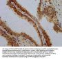 PTH Antibody