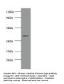 CKM Antibody