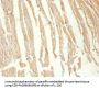 CKM Antibody