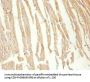 Rabbit anti-human Creatine kinase M-type polyclonal Antibody