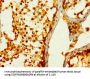STC1 Antibody