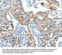 AFAP1 Antibody