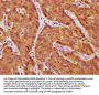AFP Antibody
