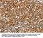 ARPC2 Antibody