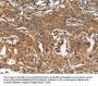 ARPC2 Antibody