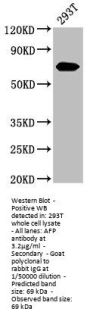 AFP Antibody