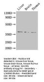 HAVCR1 Antibody