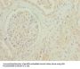 GDF15 Antibody