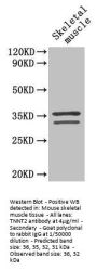 TNNT2 Antibody