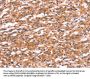 GABRA1 Antibody