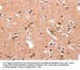 GABRA1 Antibody
