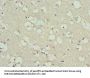 PYGB Antibody