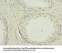 PYGB Antibody