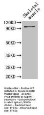 PYGB Antibody