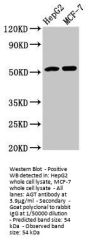 AGT Antibody