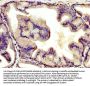 AGT Antibody