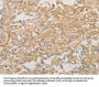 VTN Antibody
