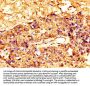 MSLN Antibody