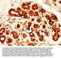 MSLN Antibody