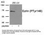 Phospho-EZR (Tyr146) Antibody
