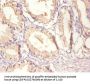 EGFR Antibody