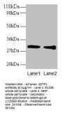 GSTP1 Antibody