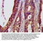 NFKB1 Antibody