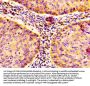 NFKB1 Antibody