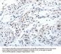 Rabbit anti-human PKD2 polyclonal antibody