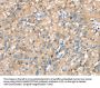 PTPN3 Antibody