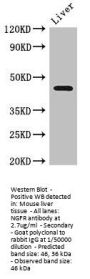 NGFR Antibody