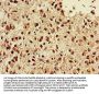NGFR Antibody
